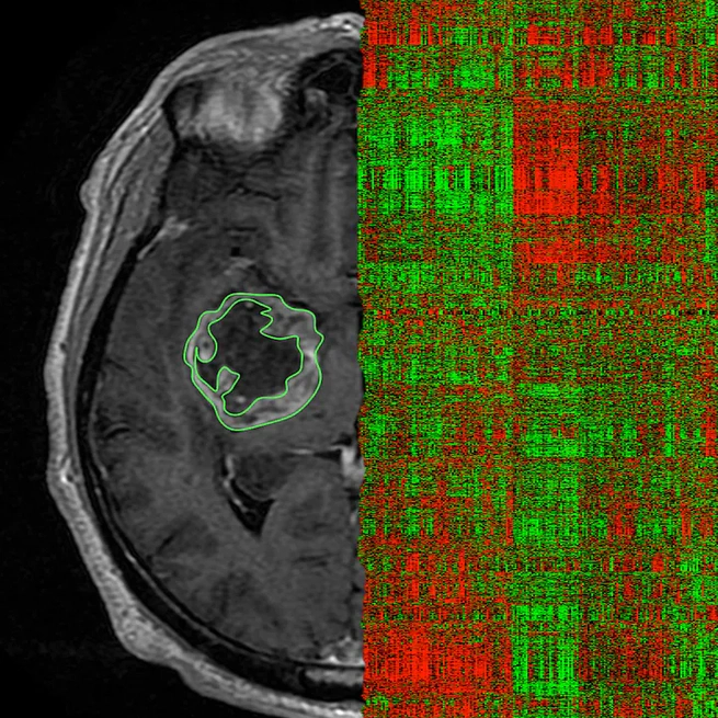 🧠 Radiomics in medical imaging: A brief introduction